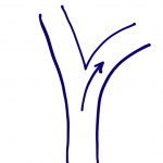Turn